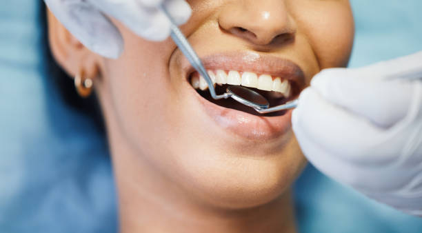 Best Walk-In Emergency Dentist in Tice, FL